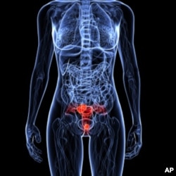 La OMS subraya la necesidad de usar la vacuna para prevenir el cáncer cervicouterino.