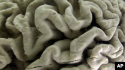 Una sección de un cerebro con Alzheimer en exhibición en el museo de Neuroanatomía de la Universidad de Buffalo, Nueva York.