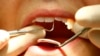 Importancia de la salud oral